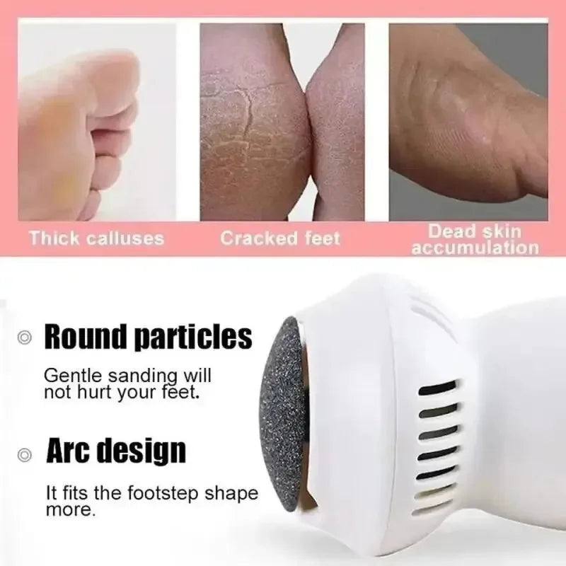 Maqiato | Electric Callus Remover for Feet