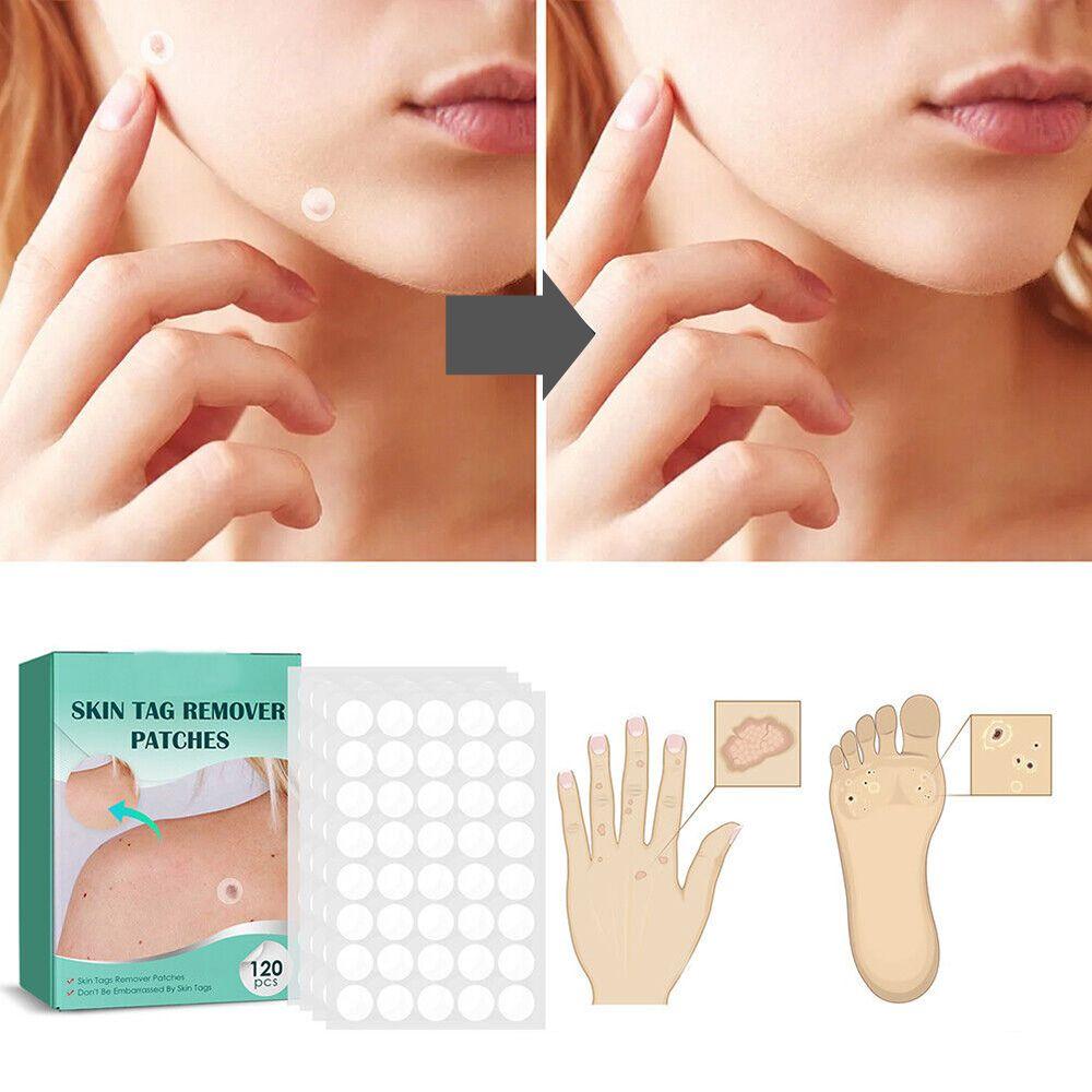 Maqiato | Skin Tag & Wart Removal Patches