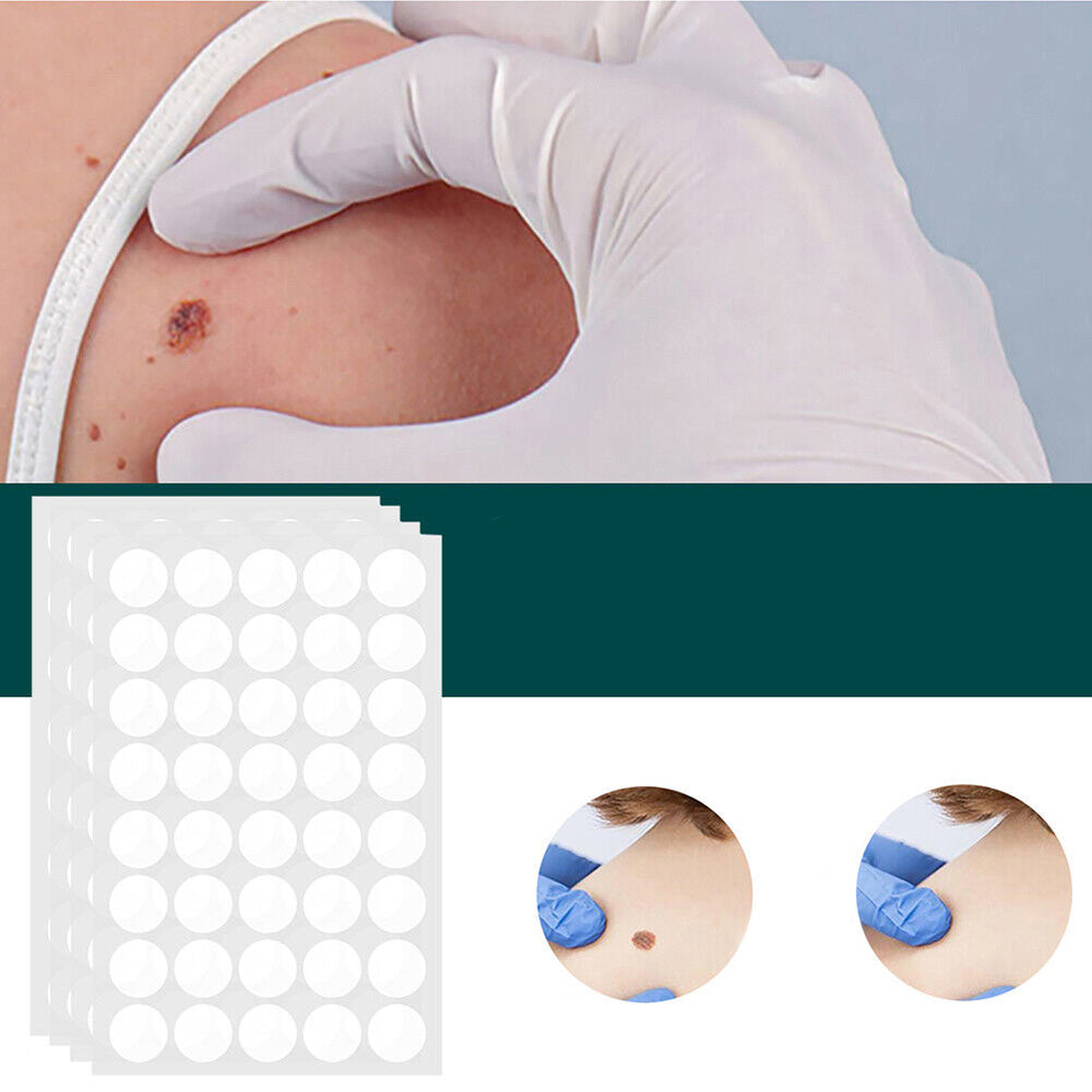Maqiato | Skin Tag & Wart Removal Patches